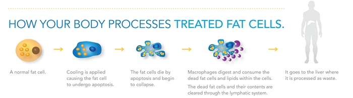 How-Your-Body-Processes-Treated-Fat-Cells