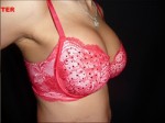 Breast Augmentation