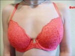 Breast Augmentation