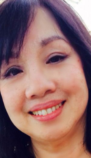 Eye Lid Surgery Case 6686 After Photo Eye Lid Surgery