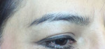 Microblading