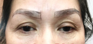 Microblading