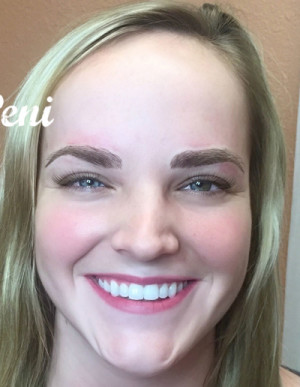 Microblading Case 7189 After Photo Microblading