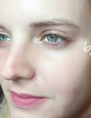 Microblading Case 7189 Before Photo Microblading