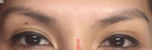 Microblading