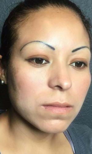 Microblading Case 7541 Before Photo Microblading