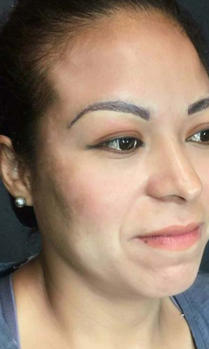 Microblading Case 7541 After Photo Microblading