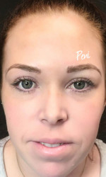 Microblading