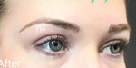 Microblading