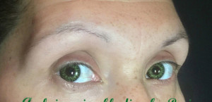 Microblading Case 7841 Before Photo Microblading