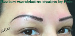 Microblading