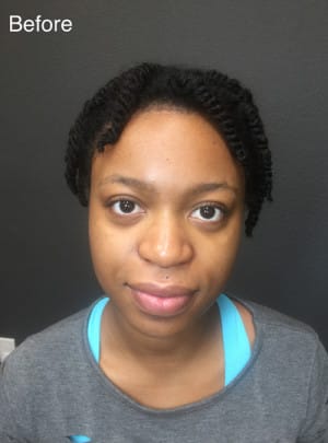 Microblading Case 8321 Before Photo Microblading