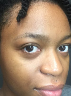 Microblading Case 8321 Before Photo Microblading