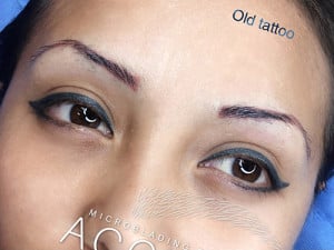 Microblading Case 8992 Before Photo Microblading