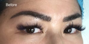 Eyebrow Tattoo Correction Case 9000 Before Photo Eyebrow Tattoo Correction