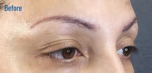 Microblading Case 9006 Before Photo Microblading