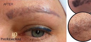 Eyebrow Tattoo Correction Case 9022 After Photo Eyebrow Tattoo Correction
