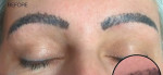 Eyebrow Tattoo Correction