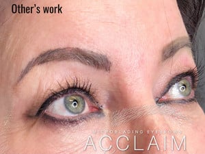 Eyebrow Tattoo Correction Case 9026 Before Photo Eyebrow Tattoo Correction