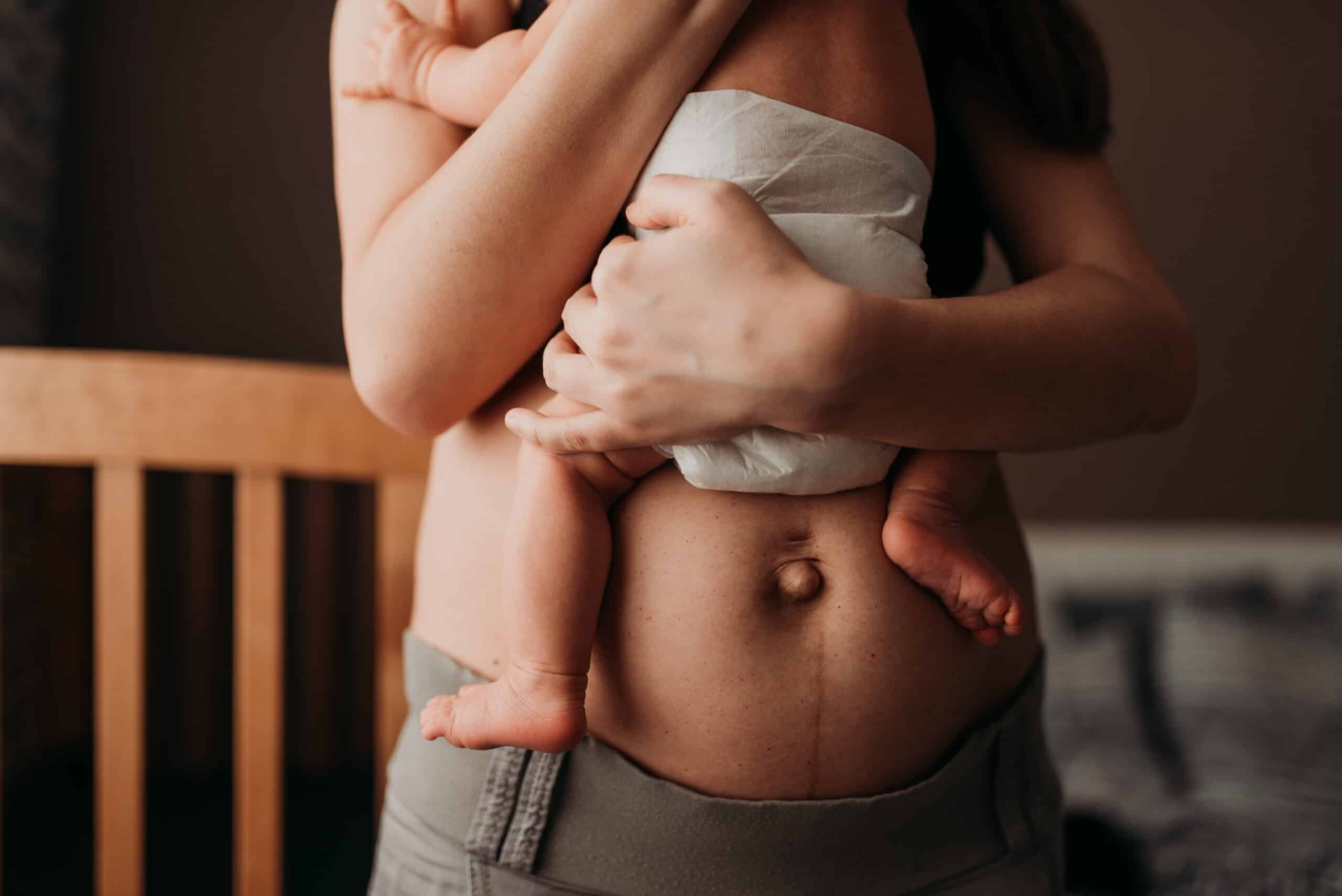 Tummy Tuck in Arlington: Do I Need a Mommy Makeover?