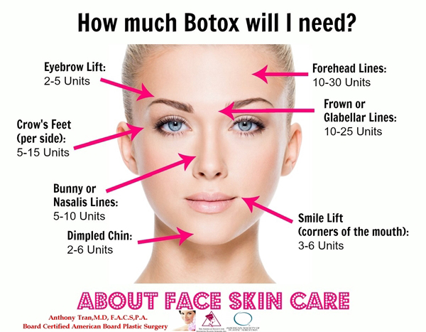 How Much Botox Will I Need