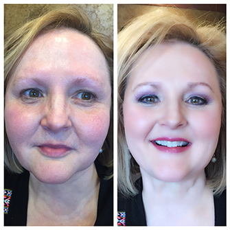 Rejuvenate MedSpa Makeup Services Before & After Photo