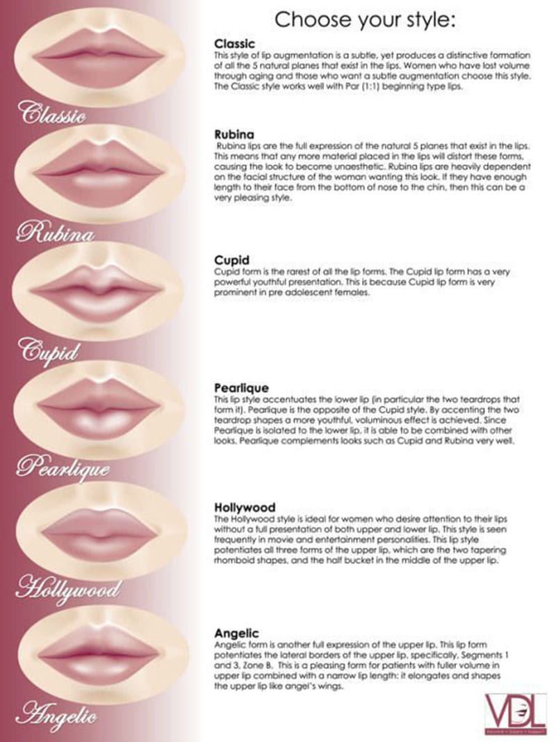 Lip Fillers