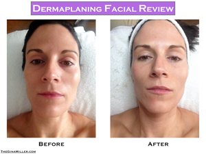 Dermaplaning Facial Review: A Simple Way To Get Glowing Skin With No Downtime